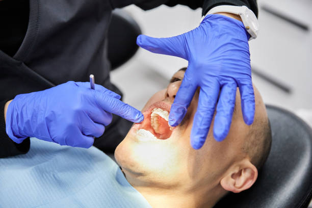 Best Emergency Tooth Extraction in Jones, OK