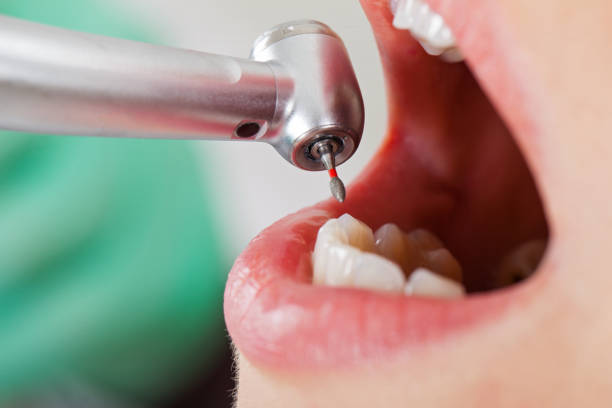 Best Emergency Gum Treatment in Jones, OK